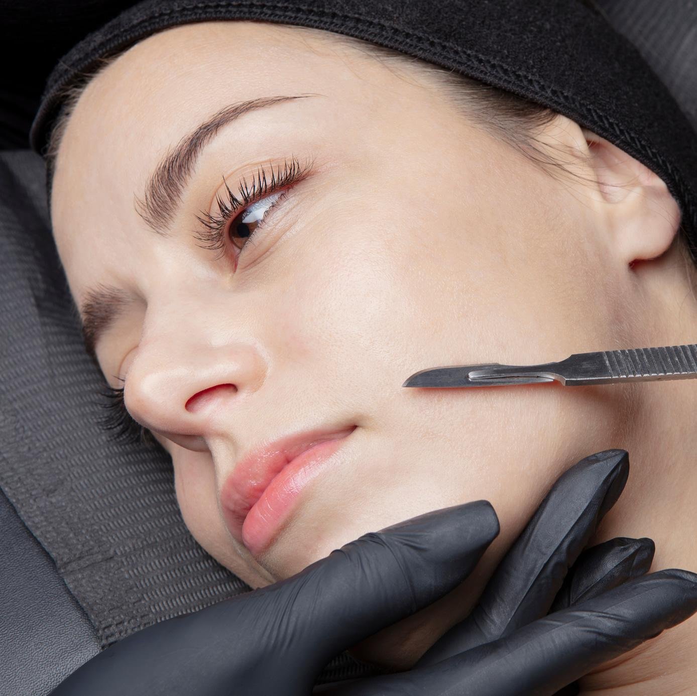 dermaplaning square1