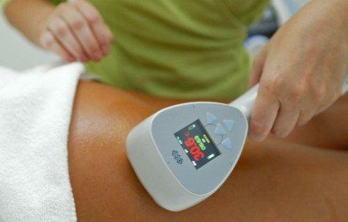 Skin tightening4
