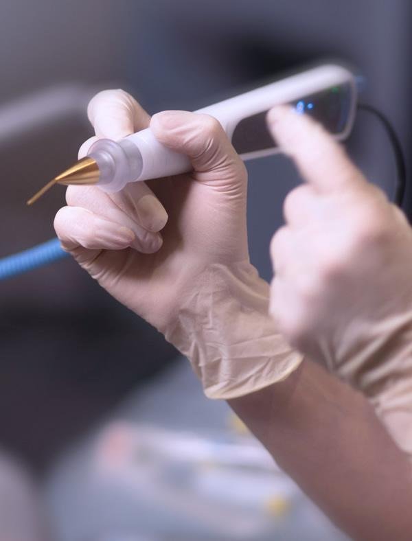 Plasma Pen