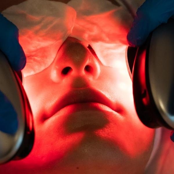 hydrafacial in wilmslow